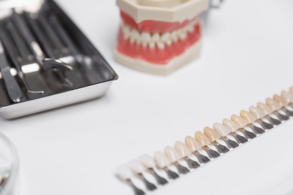 فرق ایمپلنت با کامپوزیت دندان در چیست؟