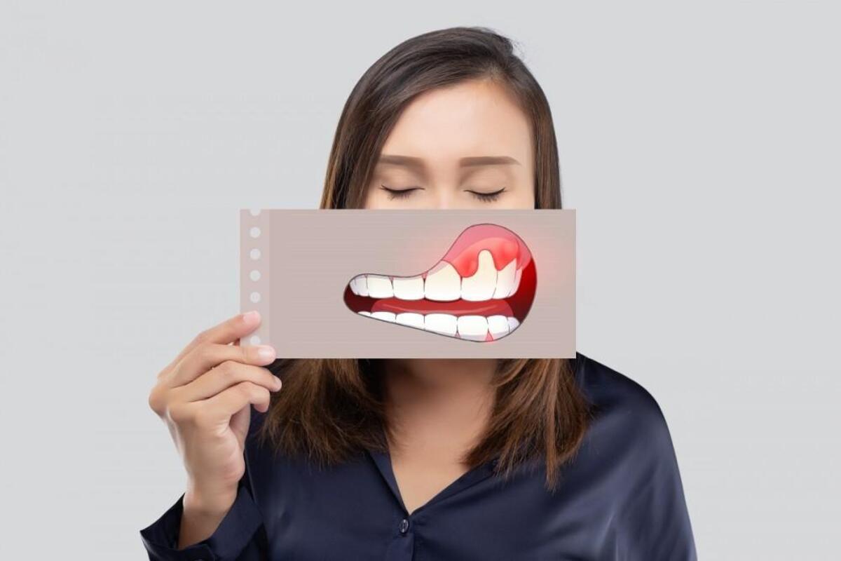 روش های درمان خانگی عفونت دندان- ۱۵ روش برای درمان عفونت دندان در خانه