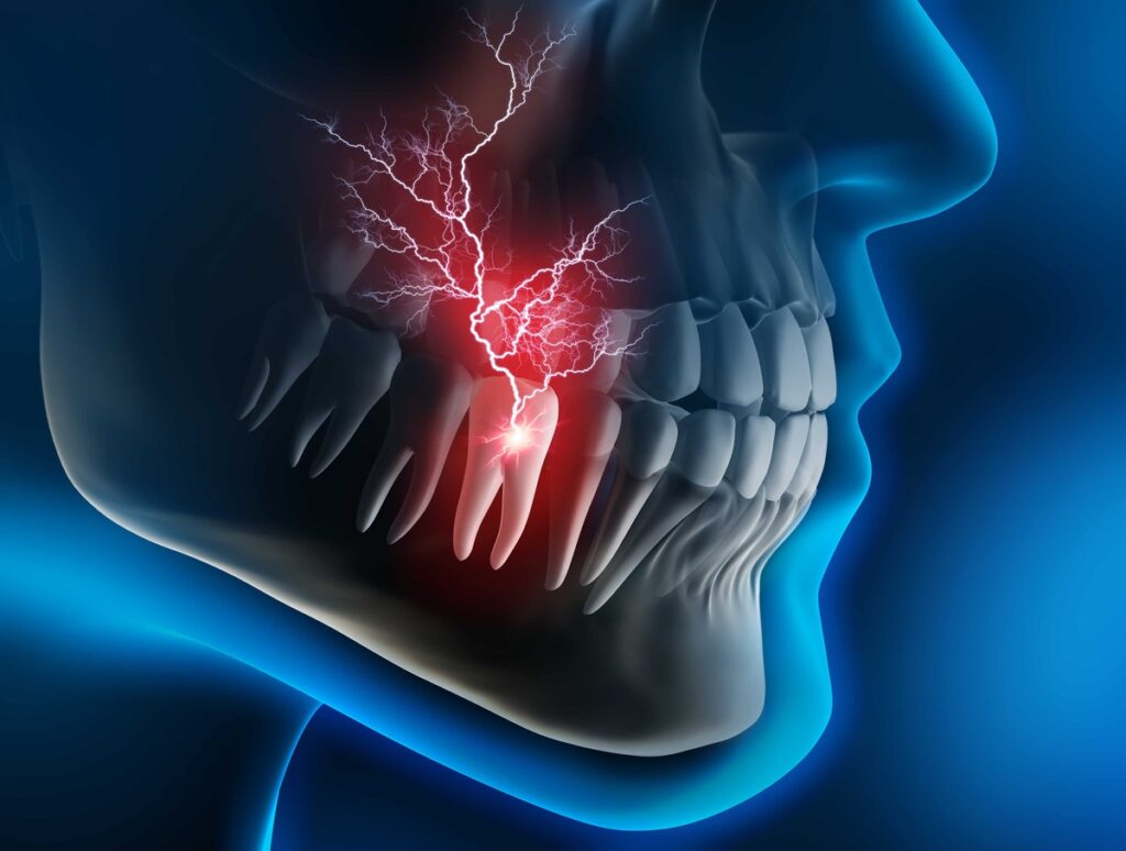 درمان سریع و طبیعی دندان درد