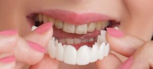 روکش دندان چیست؟ معرفی انواع روکش دندان و مزایا و معایب آن